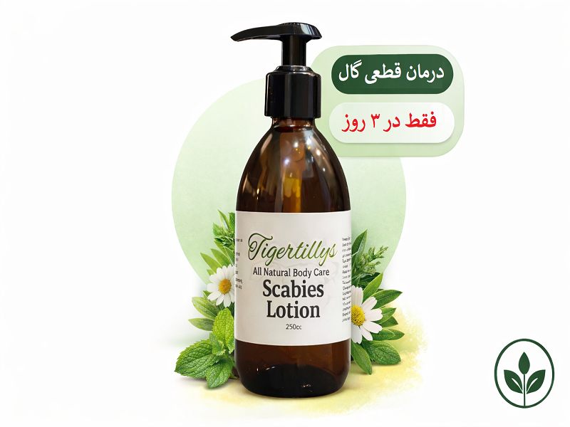 درمان قطعی گال با لوسیون گیاهی تایگرلیلیز در ۳ روز