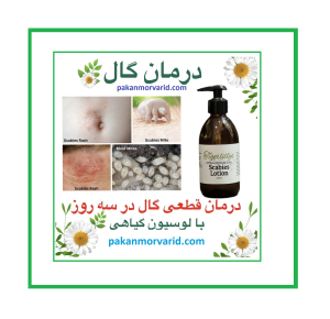 درمان گال با نمک