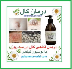 درمان گال با آمپول