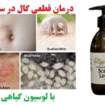 درمان گال نروژی