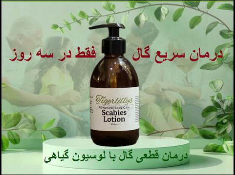 علت بیماری گال