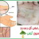 آیا بیماری گال خطرناک است