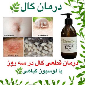 درمان گال افغانستان