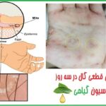 داروی گال پوستی