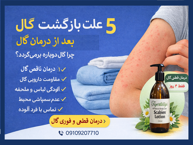 ۵ علت بازگشت گال بعد از درمان