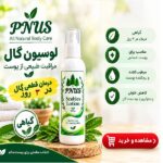 لوسیون درمان گال