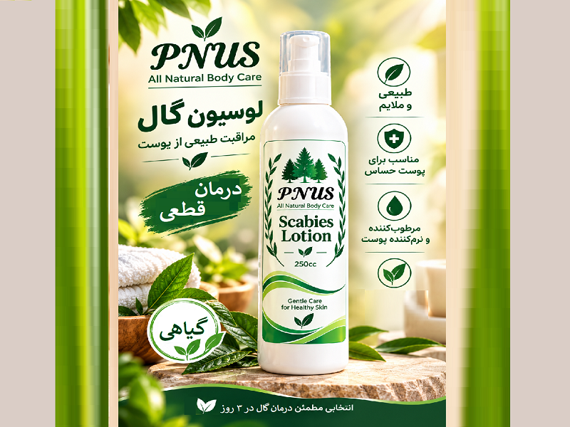 درمان گال